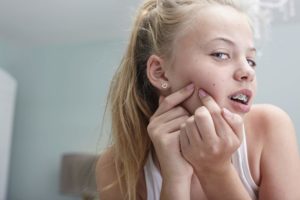 What causes teenage acne