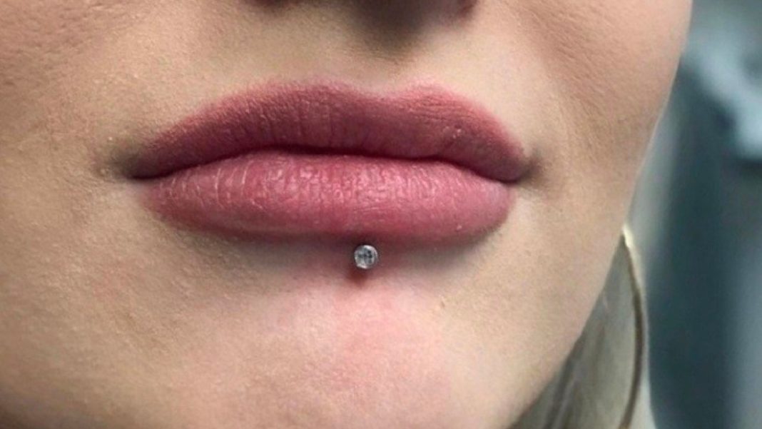 lip-piercing-and-how-to-get-rid-of-infected-lip-piercing