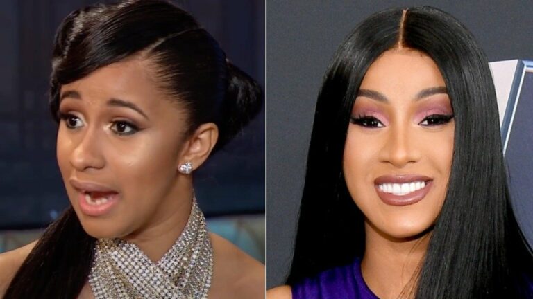 All about Cardi B Teeth Before and After - A Best Fashion