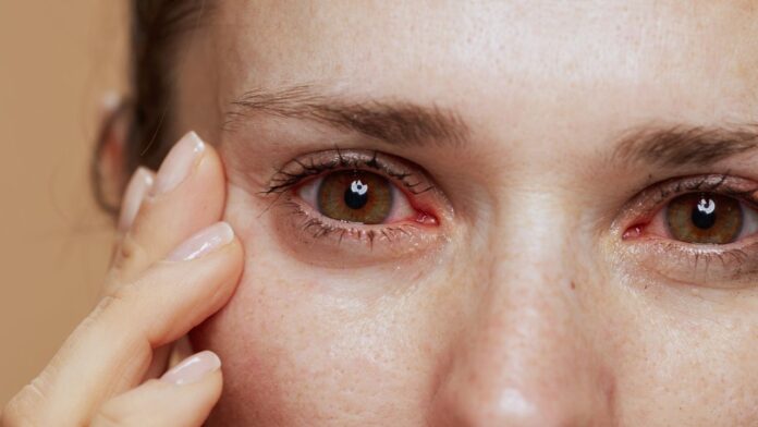 What Does Right Eye Twitching Mean in Women? Causes, Insights, and Solutions